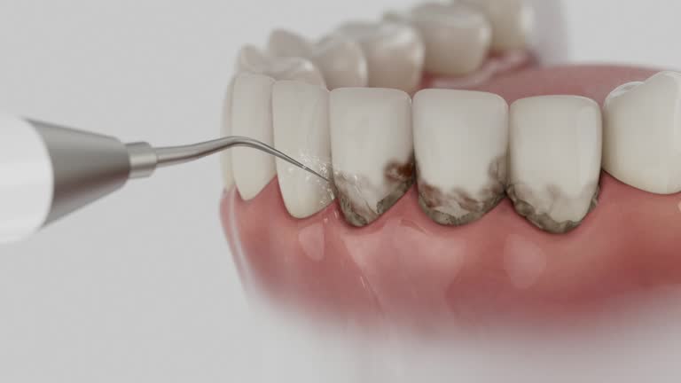 Reliable Tooth Extraction contractor in Lindsay, TX by Smile Center Dentistry